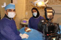 جراحي سينوس ليفت توسط دكتر وفا مشيرآبادی