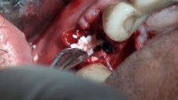 جراحی زنده - دکتر غلامی