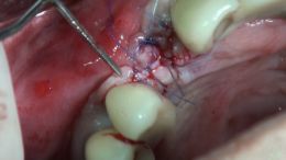 4-5-Mehr-98-Live-Surgery_7