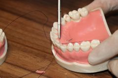 Periodontal_Crown_Length_Smile_Design_Course_July_2019_12