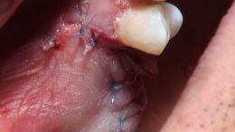 GBR - Course - 2019_10