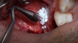 اصول مبانی GBR  - مدرس دکتر عمید