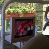 Immediate implementation and immediate loading_13