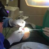 Immediate implementation and immediate loading_15