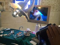 PeriAcryl tissue adhesive practical training with Live surgery