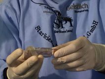 معرفي سيستم ايمپلنت SPI همراه با جراحي زنده - خرداد95