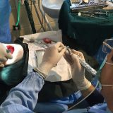 Fundamental of GBR with live surgery