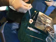 Fundamental of GBR with live surgery