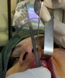 SPI system presentation with live surgery_11